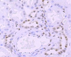 RNA Polymerase II/POLR2A (ac Ser5) Rabbit anti-Human, Mouse, Rat, Clone: